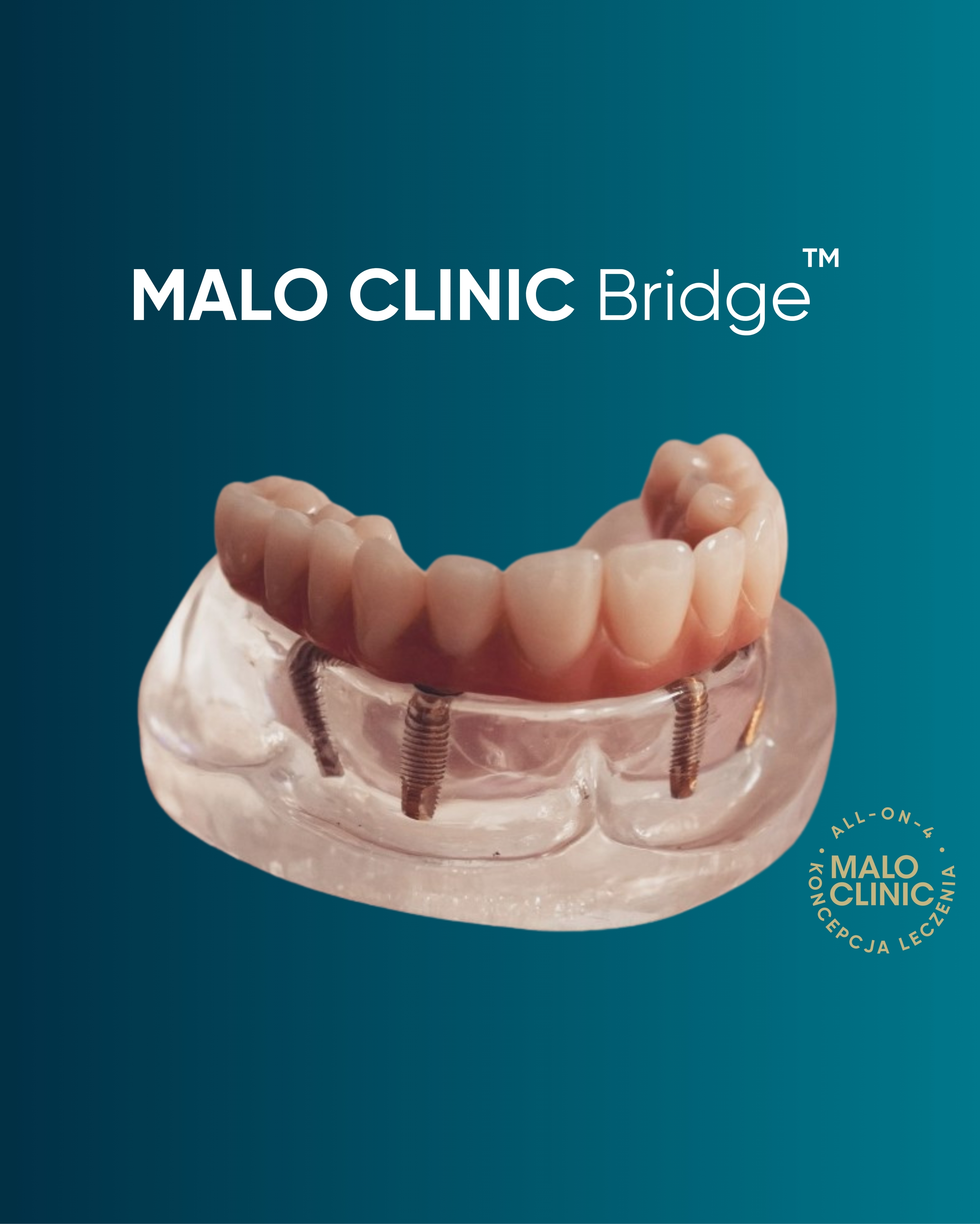 Malo Clinic Bridge™